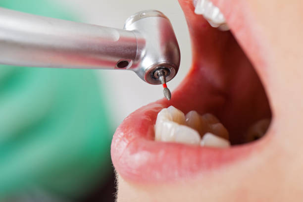 Emergency Treatment for Oral Infections